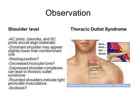 jackson head compression test|positive shoulder depression test.